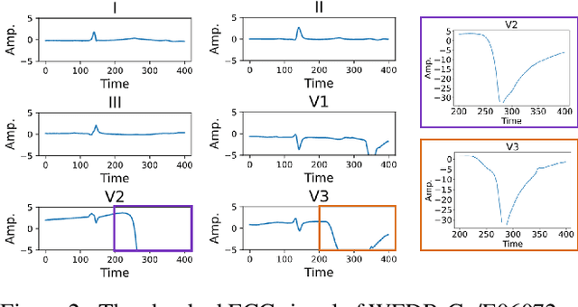 Figure 3 for A Mixed-Domain Self-Attention Network for Multilabel Cardiac Irregularity Classification Using Reduced-Lead Electrocardiogram