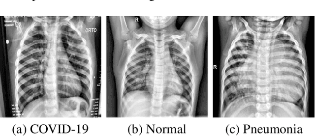 Figure 1 for Classification of COVID-19 X-ray Images Using a Combination of Deep and Handcrafted Features