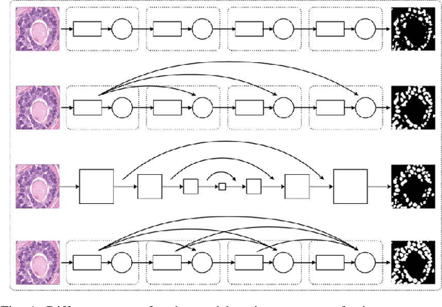 Figure 1 for Sparse Coding Driven Deep Decision Tree Ensembles for Nuclear Segmentation in Digital Pathology Images