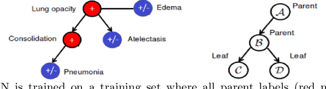 Figure 1 for Interpreting Chest X-rays via CNNs that Exploit Hierarchical Disease Dependencies and Uncertainty Labels