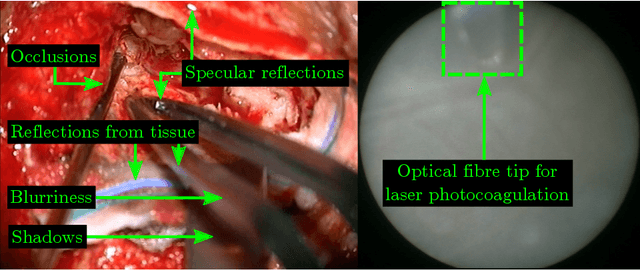 Figure 1 for Real-Time Segmentation of Non-Rigid Surgical Tools based on Deep Learning and Tracking