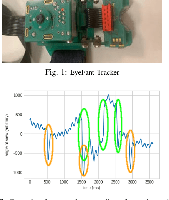 Figure 1 for Extraction of Nystagmus Patterns from Eye-Tracker Data with Convolutional Sparse Coding