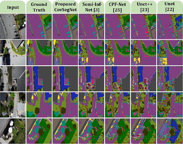 Figure 4 for CovSegNet: A Multi Encoder-Decoder Architecture for Improved Lesion Segmentation of COVID-19 Chest CT Scans