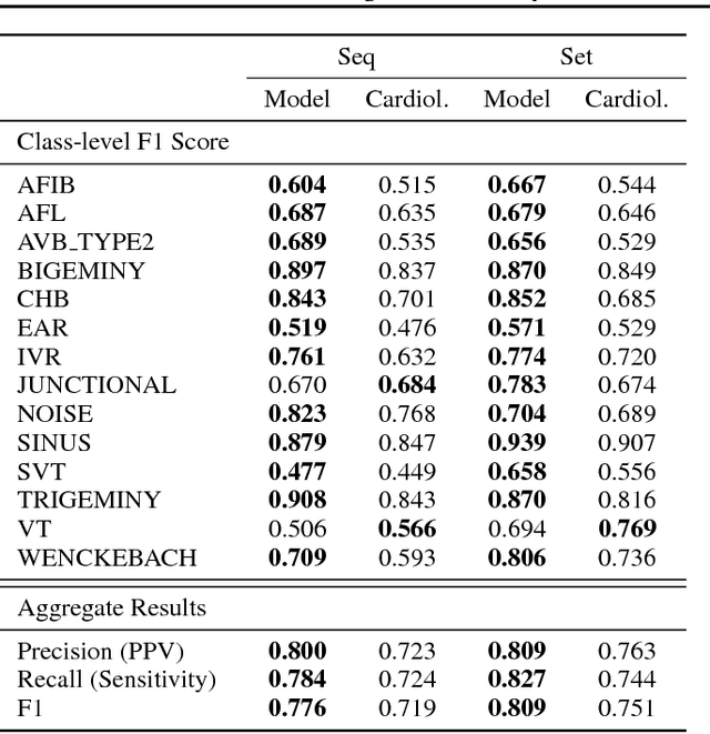 Figure 2 for Cardiologist-Level Arrhythmia Detection with Convolutional Neural Networks