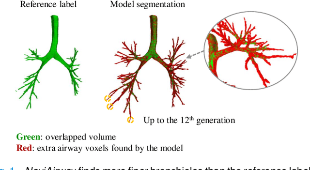 Figure 1 for NaviAirway: a bronchiole-sensitive deep learning-based airway segmentation pipeline for planning of navigation bronchoscopy