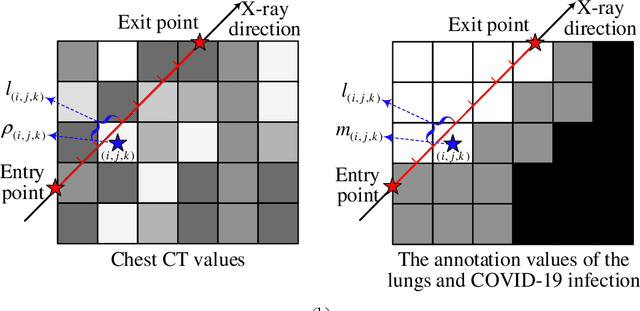 Figure 3 for DRR4Covid: Learning Automated COVID-19 Infection Segmentation from Digitally Reconstructed Radiographs