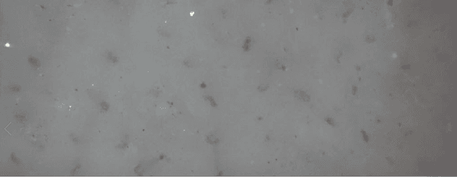 Figure 4 for CapillaryNet: An Automated System to Analyze Microcirculation Videos from Handheld Vital Microscopy