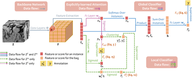 Figure 3 for Learning Inductive Attention Guidance for Partially Supervised Pancreatic Ductal Adenocarcinoma Prediction