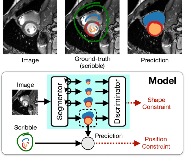 Figure 1 for Weakly Supervised Segmentation with Multi-scale Adversarial Attention Gates