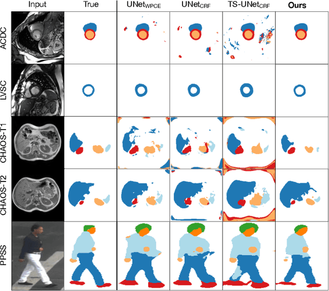 Figure 3 for Weakly Supervised Segmentation with Multi-scale Adversarial Attention Gates