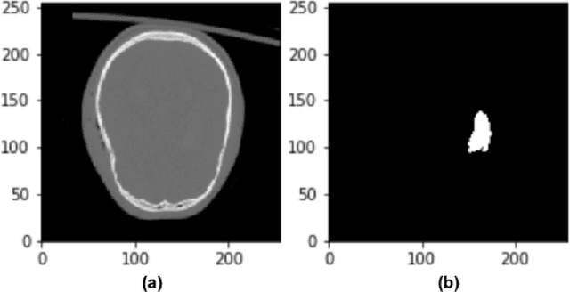 Figure 1 for A survey of loss functions for semantic segmentation