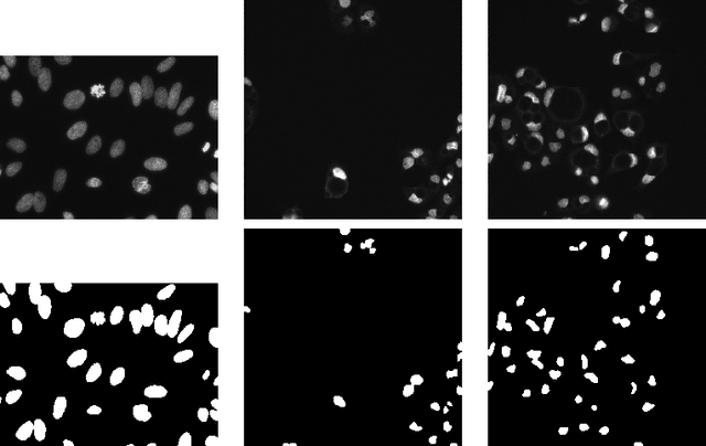 Figure 3 for Adapting Mask-RCNN for Automatic Nucleus Segmentation