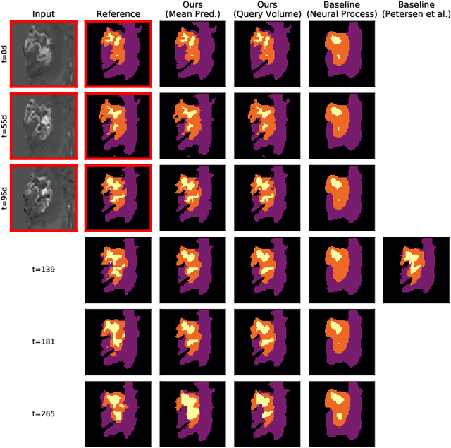 Figure 3 for Continuous-Time Deep Glioma Growth Models