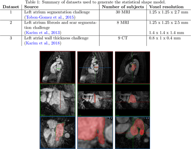 Figure 1 for A bi-atrial statistical shape model for large-scale in silico studies of human atria: model development and application to ECG simulations