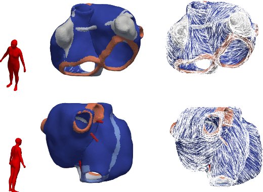 Figure 4 for A bi-atrial statistical shape model for large-scale in silico studies of human atria: model development and application to ECG simulations