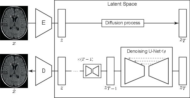 Figure 1 for Fast Unsupervised Brain Anomaly Detection and Segmentation with Diffusion Models