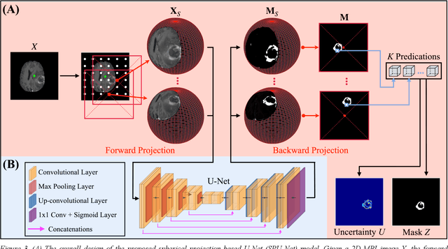 Figure 3 for Quantifying U-Net Uncertainty in Multi-Parametric MRI-based Glioma Segmentation by Spherical Image Projection