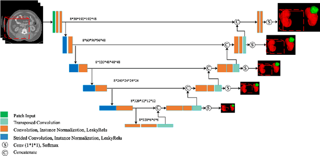 Figure 1 for Multi Scale Supervised 3D U-Net for Kidney and Tumor Segmentation