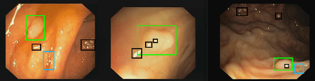 Figure 1 for Polyp-artifact relationship analysis using graph inductive learned representations