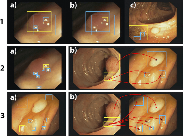 Figure 3 for Polyp-artifact relationship analysis using graph inductive learned representations