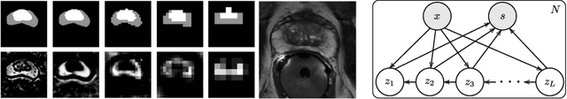 Figure 1 for PHiSeg: Capturing Uncertainty in Medical Image Segmentation