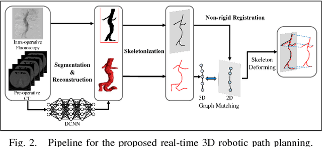 Figure 2 for 3D Path Planning from a Single 2D Fluoroscopic Image for Robot Assisted Fenestrated Endovascular Aortic Repair
