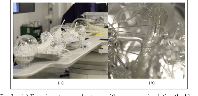 Figure 3 for 3D Path Planning from a Single 2D Fluoroscopic Image for Robot Assisted Fenestrated Endovascular Aortic Repair