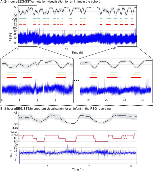 Figure 4 for Development of Sleep State Trend , a bedside measure of neonatal sleep state fluctuations based on single EEG channels