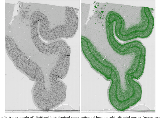 Figure 1 for Computational analysis of laminar structure of the human cortex based on local neuron features