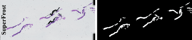 Figure 4 for DiagSet: a dataset for prostate cancer histopathological image classification