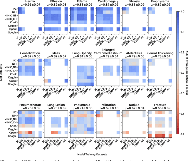 Figure 1 for On the limits of cross-domain generalization in automated X-ray prediction
