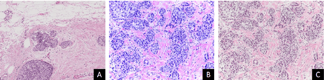 Figure 2 for Context-Aware Learning using Transferable Features for Classification of Breast Cancer Histology Images