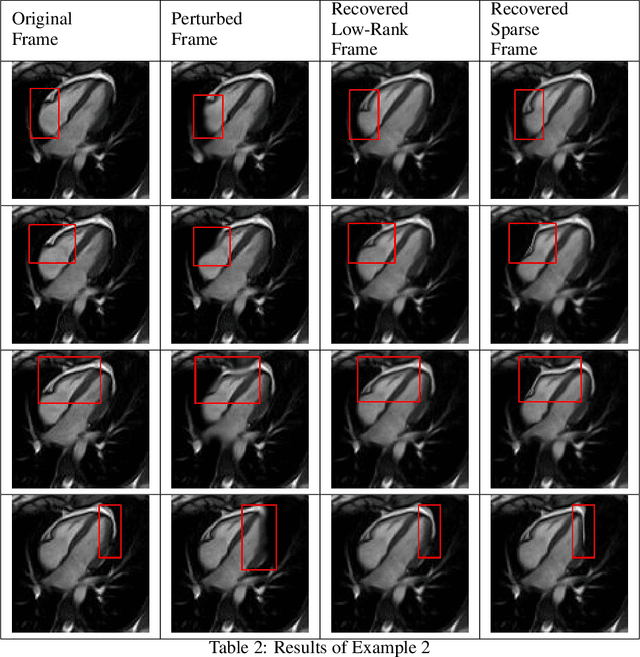 Figure 4 for Decomposition of Longitudinal Deformations via Beltrami Descriptors