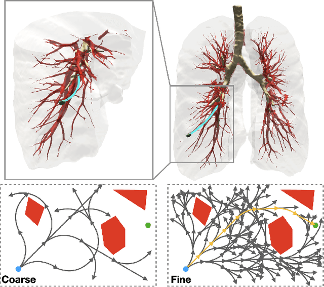 Figure 1 for Toward Certifiable Motion Planning for Medical Steerable Needles