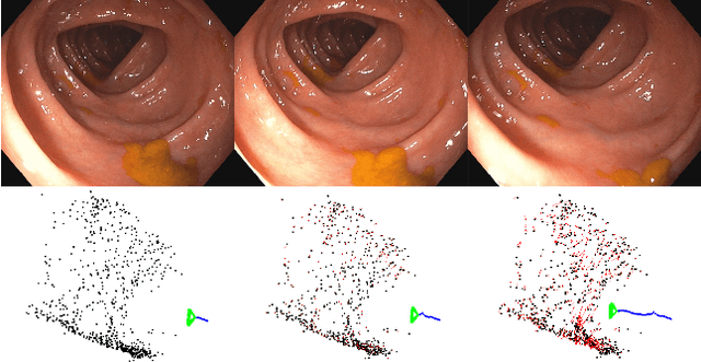 Figure 1 for Tracking monocular camera pose and deformation for SLAM inside the human body