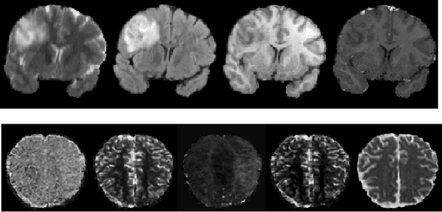 Figure 1 for Semi-supervised Learning Approach to Generate Neuroimaging Modalities with Adversarial Training