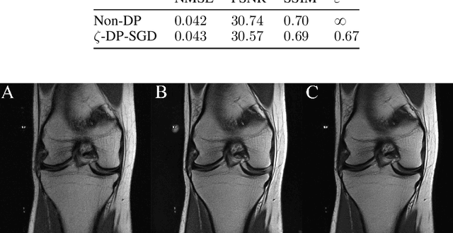 Figure 4 for Complex-valued deep learning with differential privacy