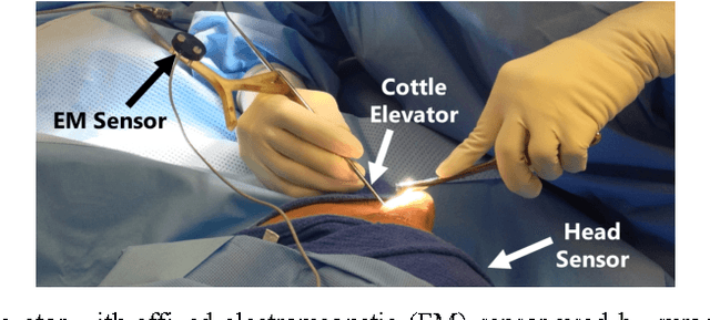 Figure 3 for Automated Objective Surgical Skill Assessment in the Operating Room Using Unstructured Tool Motion