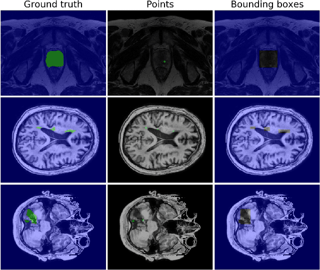 Figure 1 for Bounding boxes for weakly supervised segmentation: Global constraints get close to full supervision