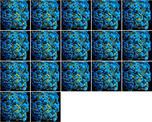 Figure 2 for Unsupervised automatic classification of Scanning Electron Microscopy (SEM) images of CD4+ cells with varying extent of HIV virion infection