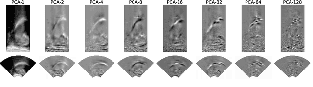 Figure 4 for Extending Text-to-Speech Synthesis with Articulatory Movement Prediction using Ultrasound Tongue Imaging