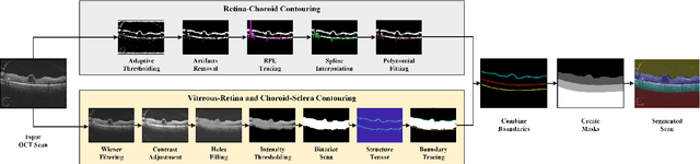 Figure 1 for Automated segmentation and extraction of posterior eye segment using OCT scans