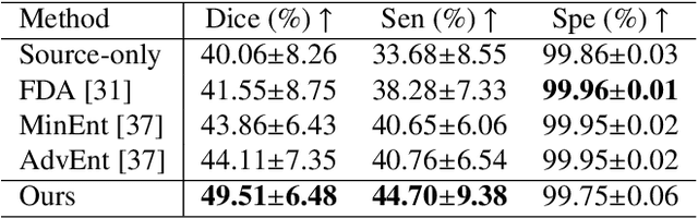 Figure 2 for A Teacher-Student Framework with Fourier Augmentation for COVID-19 Infection Segmentation in CT Images