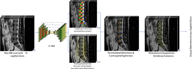 Figure 4 for SpineNetV2: Automated Detection, Labelling and Radiological Grading Of Clinical MR Scans