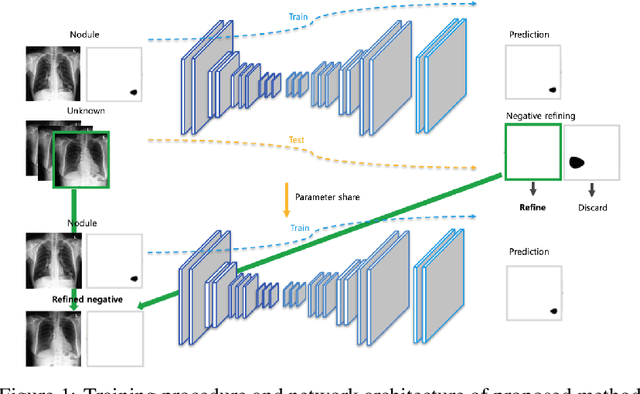 Figure 1 for False Positive Reduction by Actively Mining Negative Samples for Pulmonary Nodule Detection in Chest Radiographs