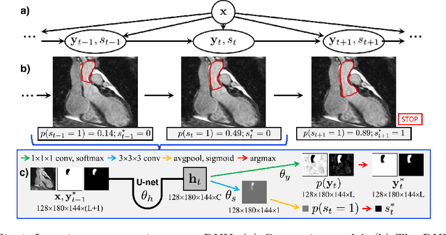 Figure 1 for Iterative Segmentation from Limited Training Data: Applications to Congenital Heart Disease