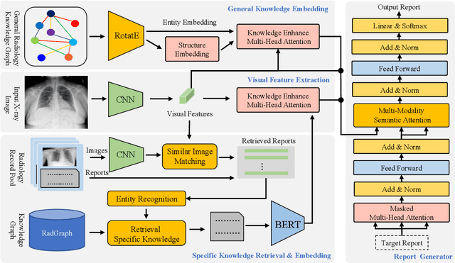 Figure 1 for Knowledge Matters: Radiology Report Generation with General and Specific Knowledge