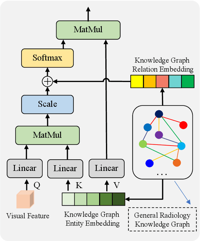 Figure 3 for Knowledge Matters: Radiology Report Generation with General and Specific Knowledge