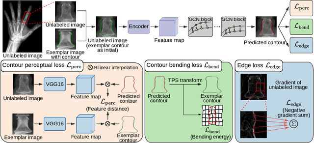 Figure 1 for Learning to Segment Anatomical Structures Accurately from One Exemplar