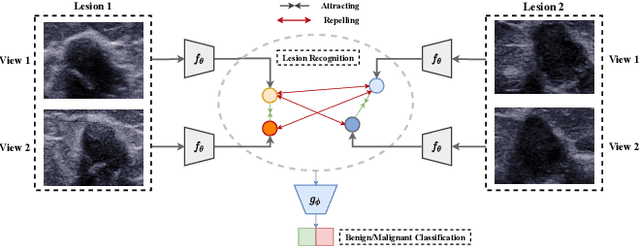 Figure 1 for Self Supervised Lesion Recognition For Breast Ultrasound Diagnosis